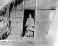 Woman in Weichang, goitred throat. Photograph taken by William Purdom on his 1909-1910 travels in China.